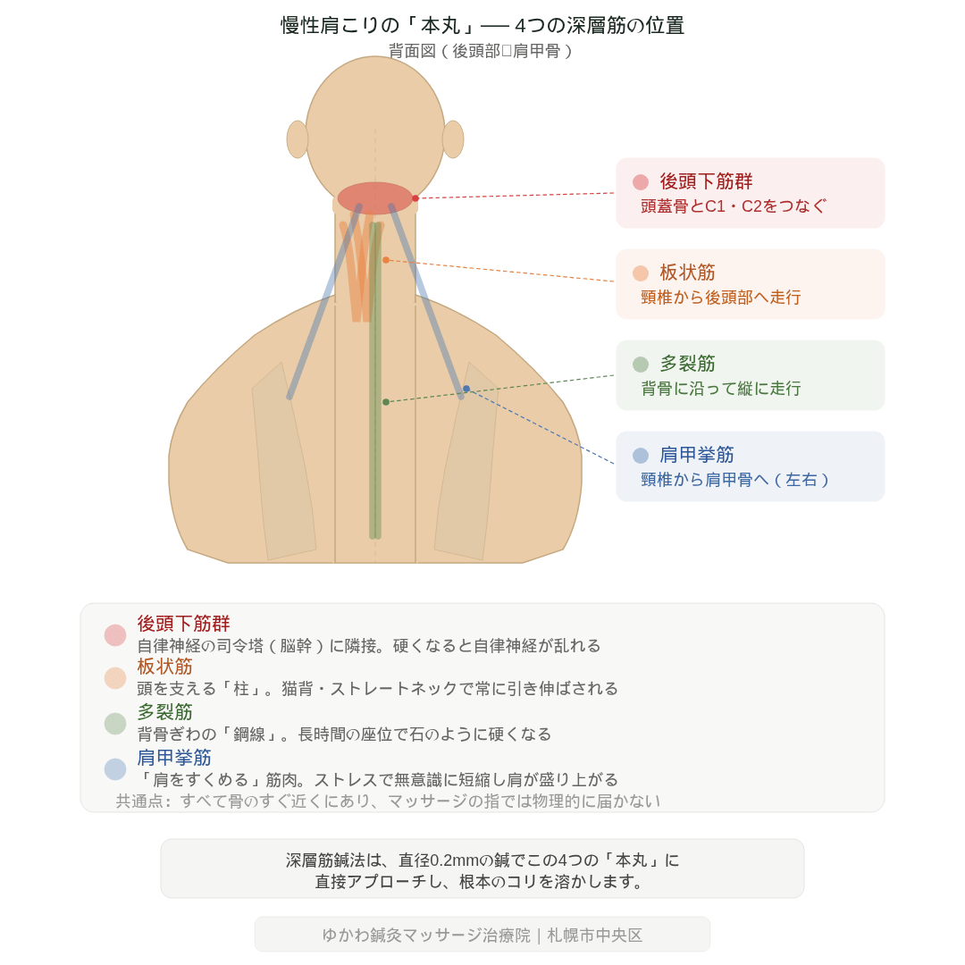 慢性肩こりに関わる4つの深層筋 ── 後頭下筋群・板状筋・多裂筋・肩甲挙筋の位置を示す図解