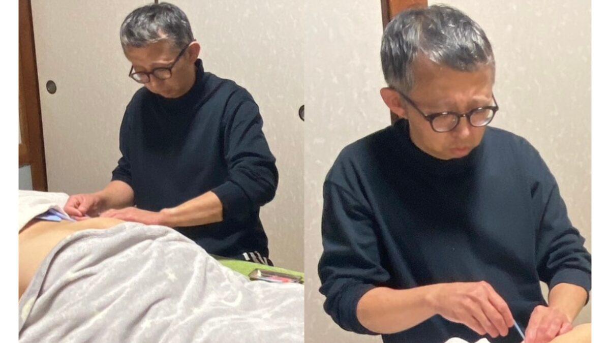 ゆかわ鍼灸マッサージ治療院での腰痛に対する深層筋鍼法の施術風景